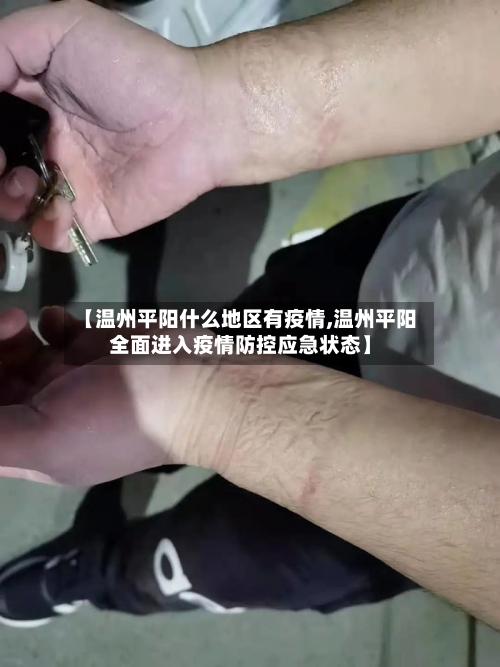 【温州平阳什么地区有疫情,温州平阳全面进入疫情防控应急状态】